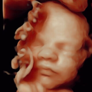 3D 4D pretecho gemaakt bij Goud echo en prenatale screening