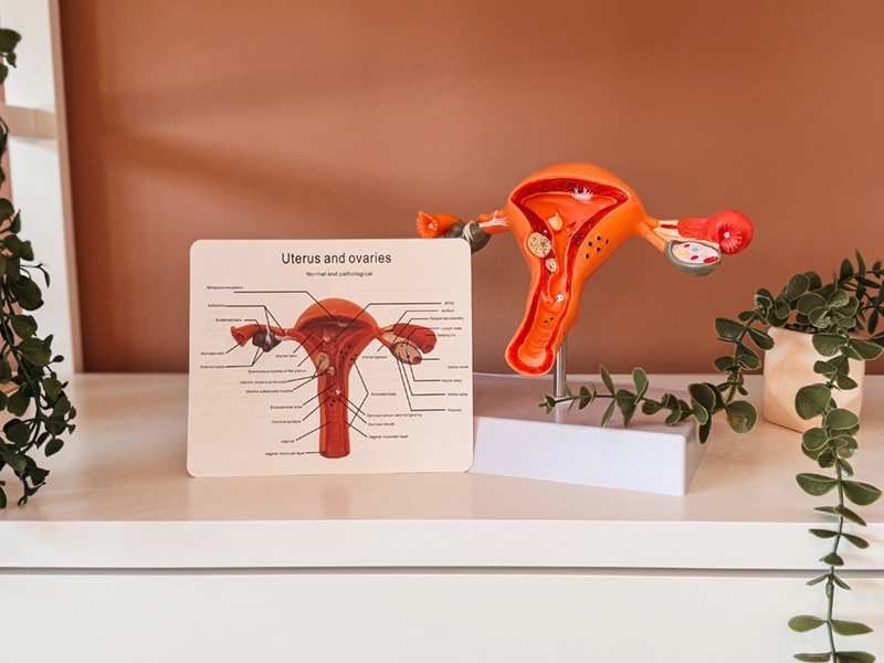 Gynaecologische echo om baarmoeder en eierstokken te controleren